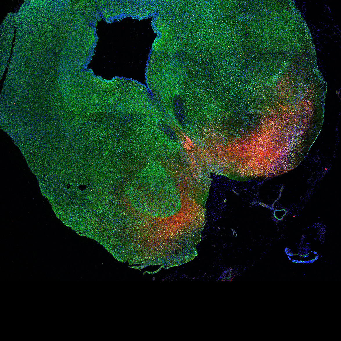 Human foetal midbrain